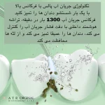 واتر جت شست و شوی دهان و دندان مدل A8